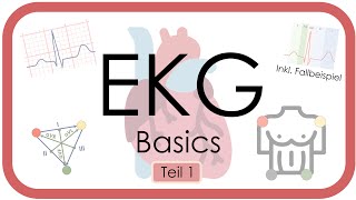 EKG Basics  Step by Step  Grundlagen Einthoven Frequenz Lagetyp PWelle QRS EKGKurs [upl. by Eicarg]