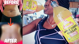 Does Apple Cider Help Lose Weight  Apple Cider Vinegar Weight Loss With Results [upl. by Gualtiero834]