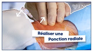 Tuto ENC  comment réaliser une ponction radiale  animation 3D [upl. by Tenneb]