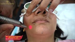 Famous Beautician Sawera Khan take Skin tightening treatment for world best laser Fotona Laser [upl. by Boone]