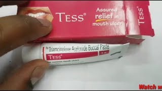 Tess buccal paste review in tamil  mouth ulcer gel in tamil [upl. by Adnauqal]