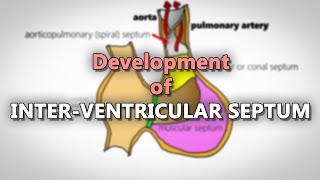 Endoscopic Mitral Valve Repair Minimally Invasive Cardiac Surgery Fortis Healthcare Limited India [upl. by Fretwell3]