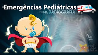 Emergências Pediátricas na Radiografia [upl. by Tuppeny]