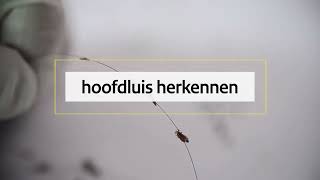 Hoofdluis herkennen [upl. by Sonitnatsnok]