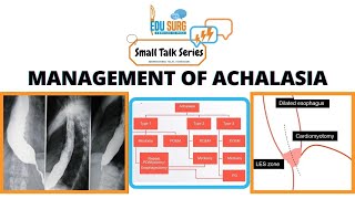 Achalasia cardia management [upl. by Asenev836]