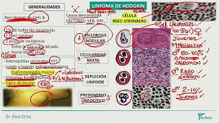 Hematología  Linfoma de hodgkin linfoma no hosgkin mieloma multiple sindrome de lisis tumoral [upl. by Htehpaj]