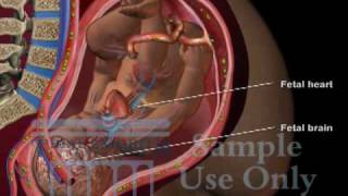 Umbilical Cord Compression  Maternal Fetal Circulation Medical 3D Animation [upl. by Gabe]