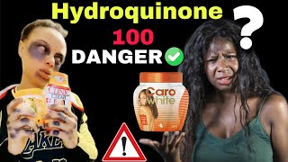 🤔Hydroquinone bon ou mauvais ❓ [upl. by Dud]