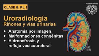 081  Uroradiología  Anatomía por imagen y malformaciones congénitas [upl. by Enitsyrhc878]